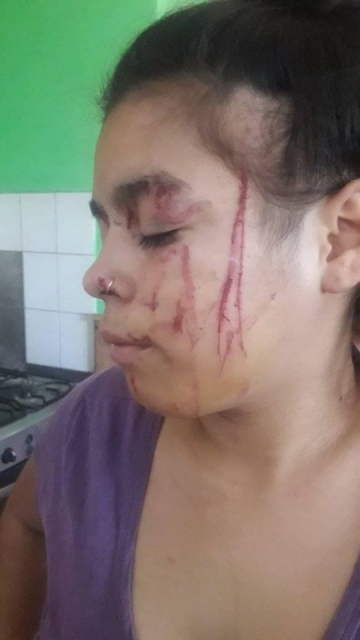 Marcos Juárez: 8 adolescentes golpearon salvajemente a una menor