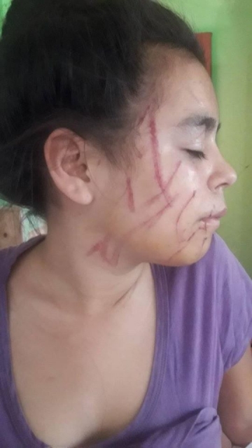 Marcos Juárez: 8 adolescentes golpearon salvajemente a una menor
