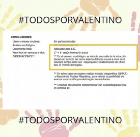 “Todos por Valentino”: necesita una costosa cirugía antes de la semana 27 de gestación 
