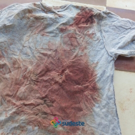 Bombero sufre herida intentando salvar a un oso hormiguero 